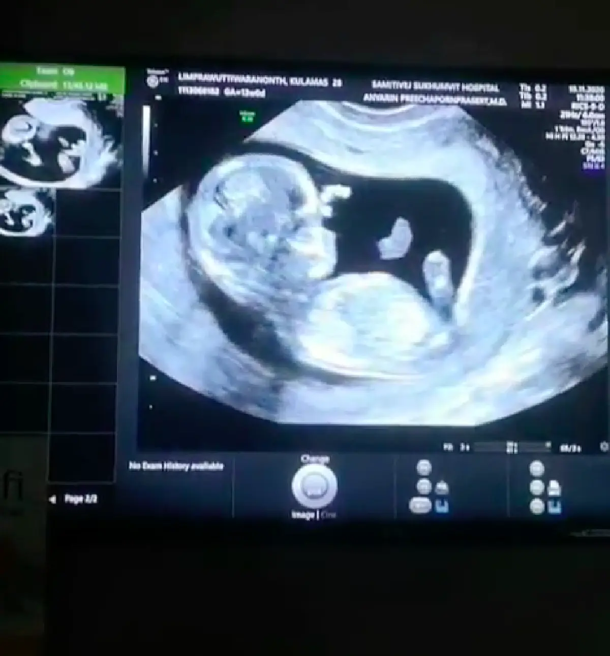 “ขนมจีน กุลมาศ” ประกาศข่าวดี! ตั้งท้องลูกคนแรกแล้ว พร้อมเผยภาพอัลตราซาวด์ให้ได้ชม