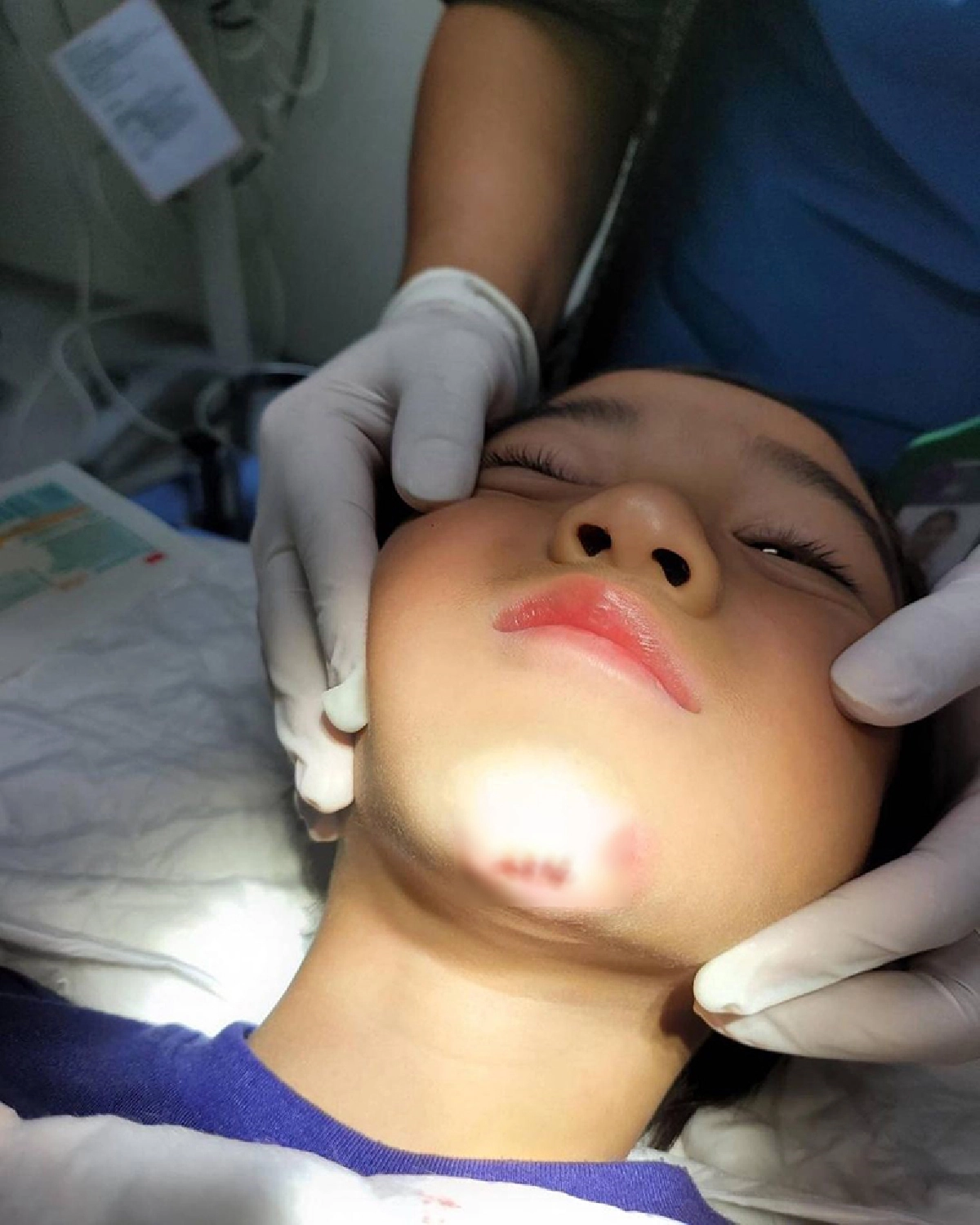 “กบ สุวนันท์” เผยลูกชาย “น้องณดล” วิ่งลื่นล้มจนคางแตก แต่ไม่ร้องสักแอะ