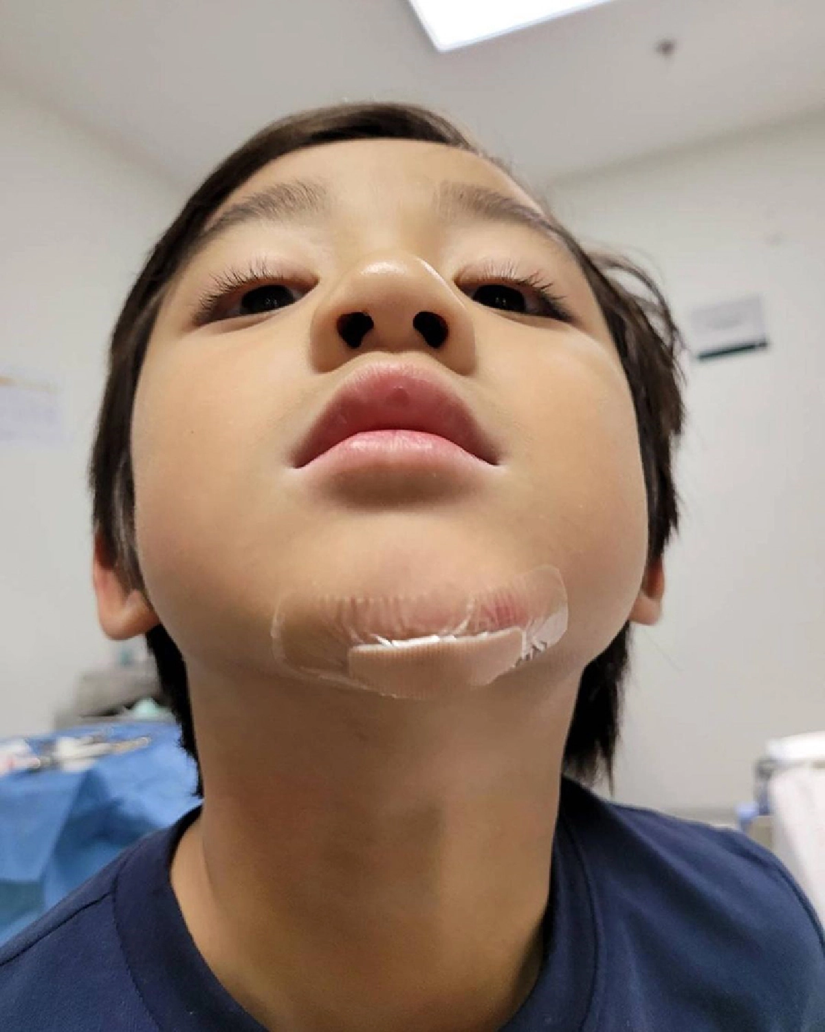 “กบ สุวนันท์” เผยลูกชาย “น้องณดล” วิ่งลื่นล้มจนคางแตก แต่ไม่ร้องสักแอะ