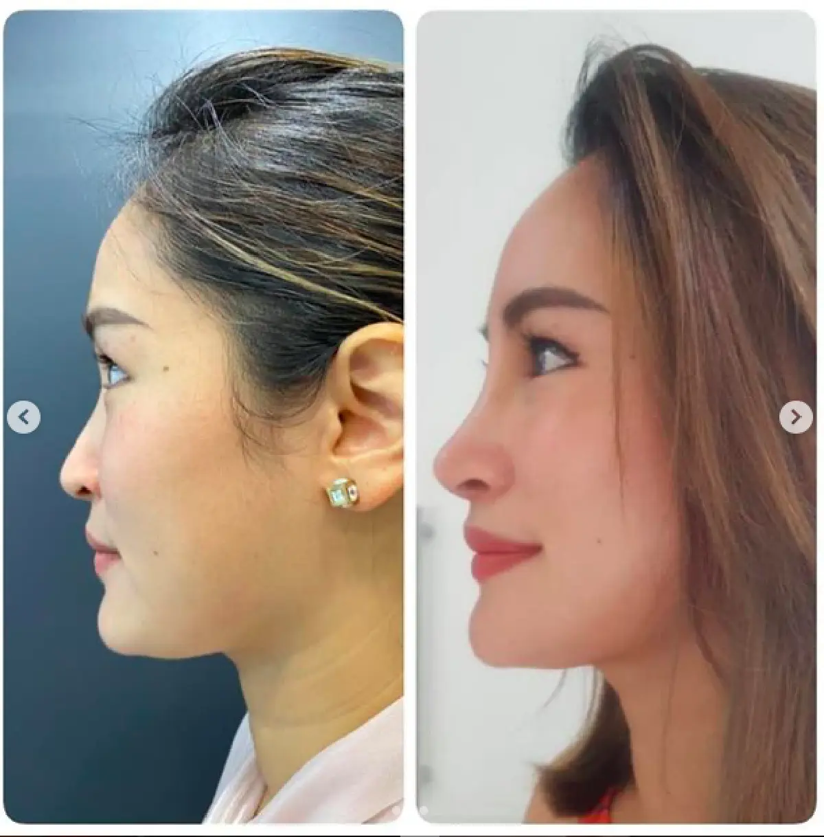 “พลอย พลอยพรรณ” เผยภาพก่อน-หลังอัปดั้ง แววสวยมาแล้วแม้จะยังไม่เข้าที่