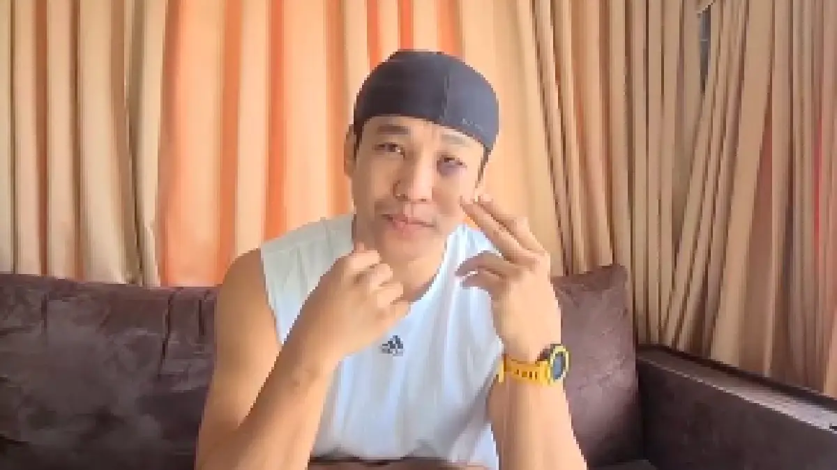 "เอ็กซ์ ธิตินันท์" อัปเดตอาการวันที่ 2 หลังชกกับ "รัศมีแข" เบ้าตาแตก จมูกอ่อนหักสองข้าง