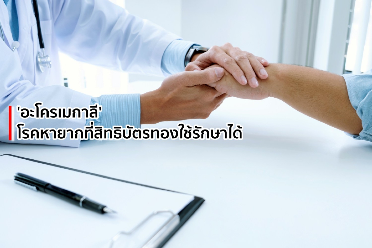 'อะโครเมกาลี' โรคหายากที่สิทธิบัตรทองใช้รักษาได้ 'อะโครเมกาลี' โรคหายากที่สิทธิบัตรทองใช้รักษาได้