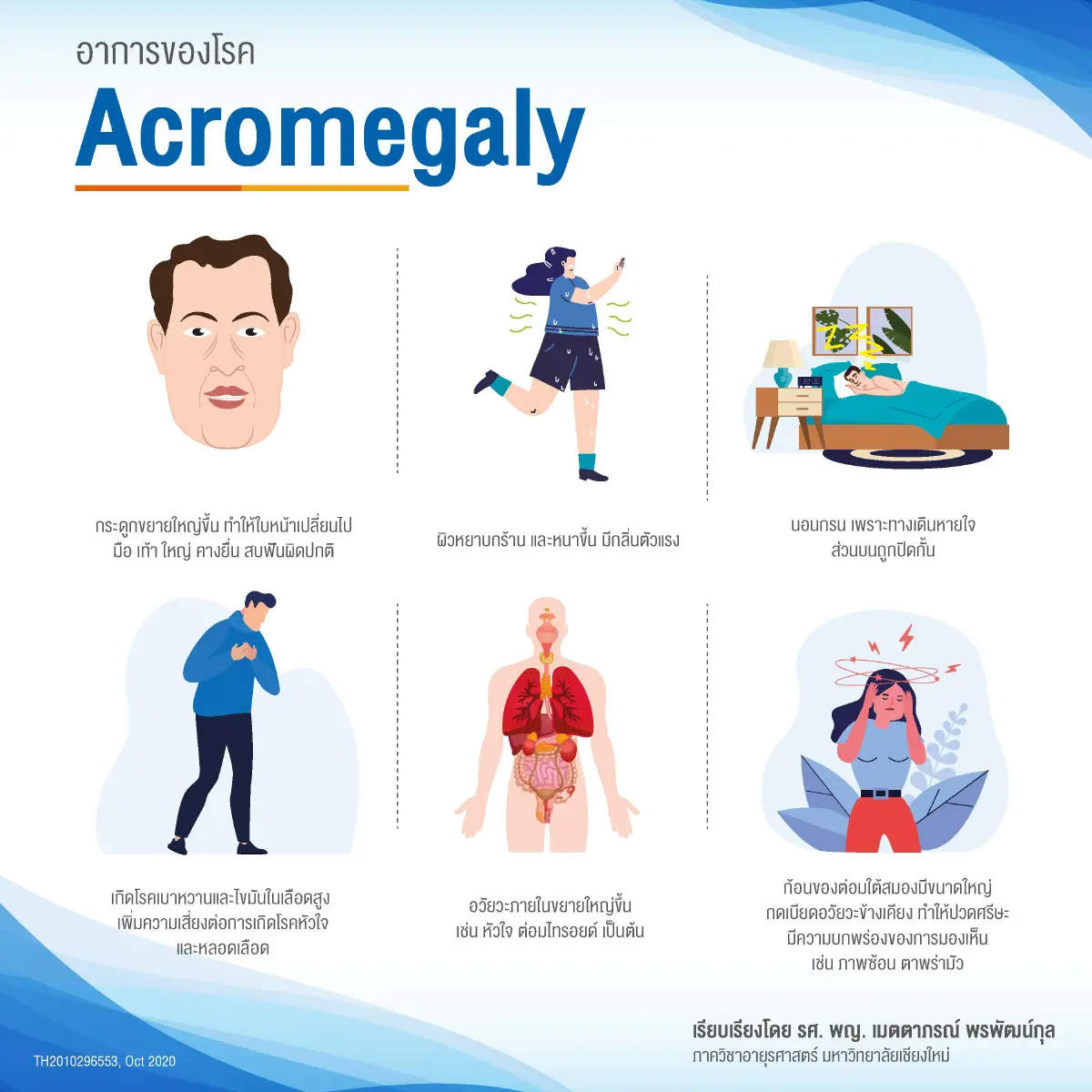 'อะโครเมกาลี' โรคหายากที่สิทธิบัตรทองใช้รักษาได้