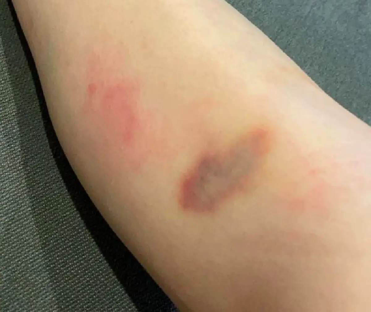 "ใบเฟิร์น พิมพ์ชนก" เผยคลิปวินาทีที่ตกม้าจนตัวลอย "ญาญ่า" รีบเข้าไปช่วยดูแล