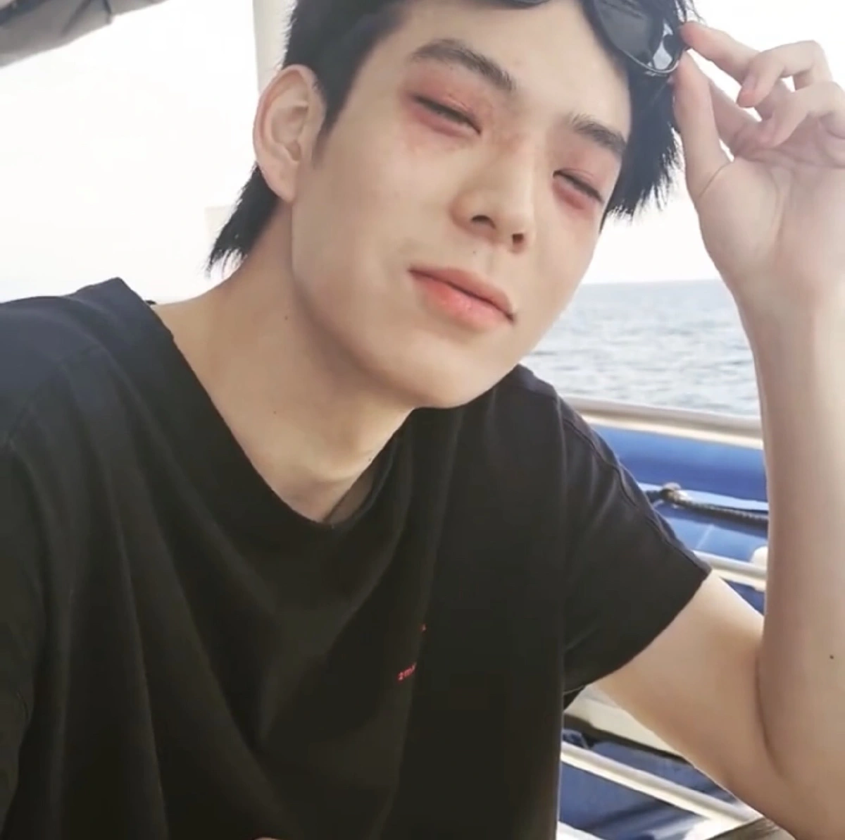 "เจเจ กฤษณภูมิ" เผยสาเหตุทำไมเบ้าตาถึงแดงช้ำทั้งสองข้างหนัก