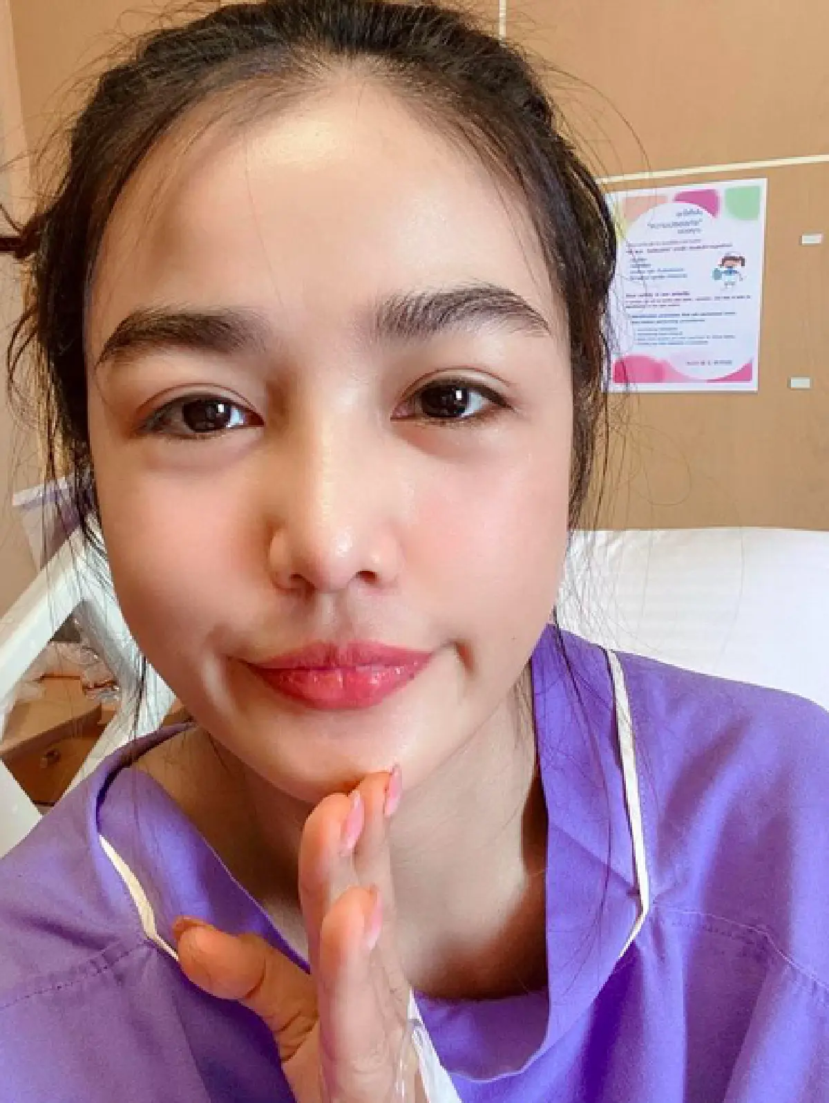 "กระแต อาร์สยาม" ลื่นล้มขาฟาดขอบสระเป็นแผลลึกฉกรรจ์  โดนเย็บ 17 เข็ม