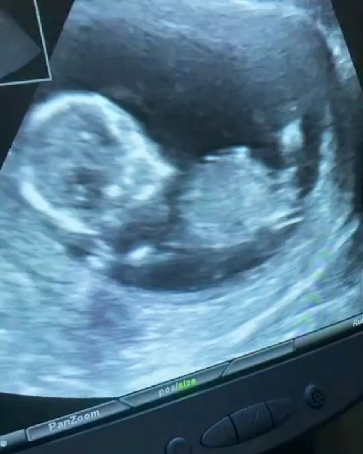 ต๊ะ วริษฐ์ ดีใจกำลังจะเป็นพ่อคนแล้ว หลังจากเคยสูญเสียลูกถึงสองครั้ง