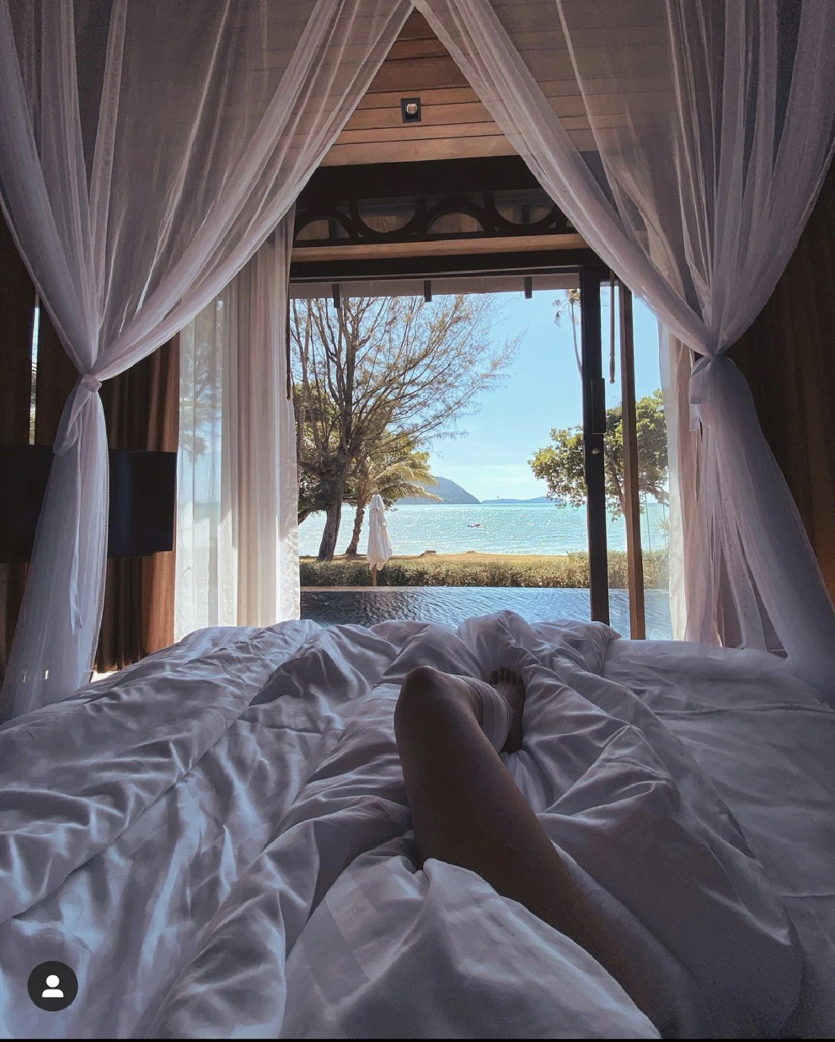 กระแต อาร์สยาม ตอบทุกคำถาม! ทำไมไม่พัก..เที่ยวต่อไม่รอแผลหาย