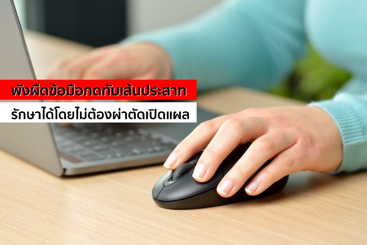 พังผืดข้อมือกดทับเส้นประสาท รักษาได้โดยไม่ต้องผ่าตัดเปิดแผล พังผืดข้อมือกดทับเส้นประสาท รักษาได้โดยไม่ต้องผ่าตัดเปิดแผล