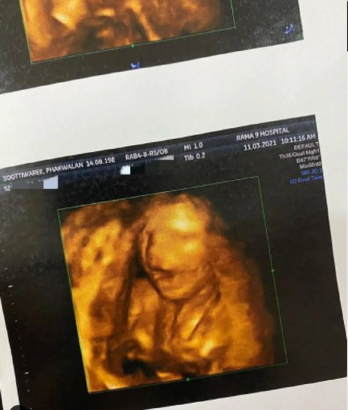 เฮอีกครั้ง! บอย โชคชัย ประกาศข่าวดี ภรรยาท้องลูกคนที่ 2 แล้ว