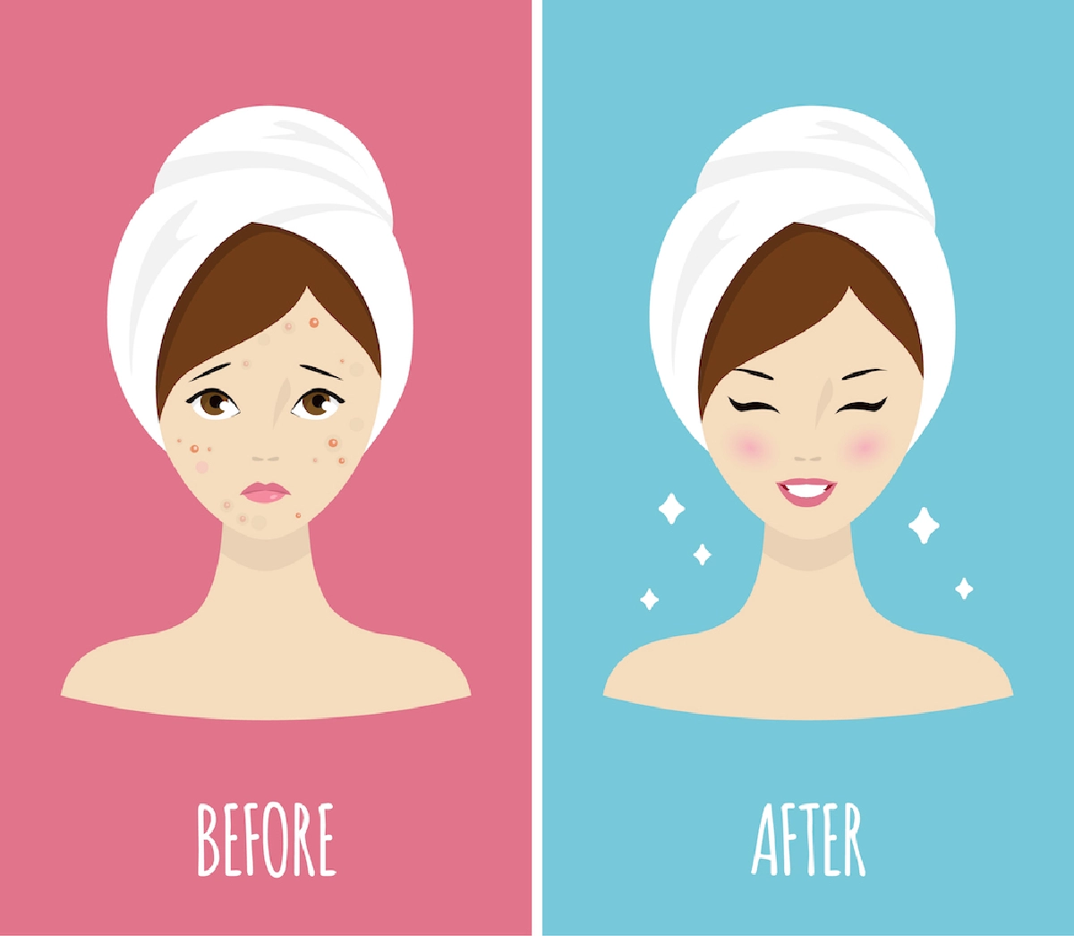 'สิว' ปัญหาที่ไม่ใช่เรื่องสิวๆ ของทุกช่วงวัย