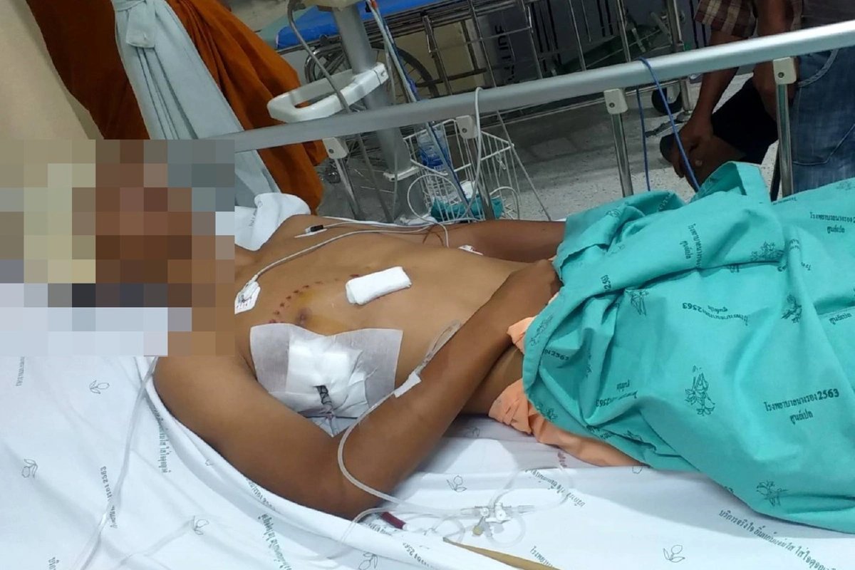 โหดเกิน!รับไม่ได้ลูกชายวัย17ถูกรุมทำร้ายปางตาย