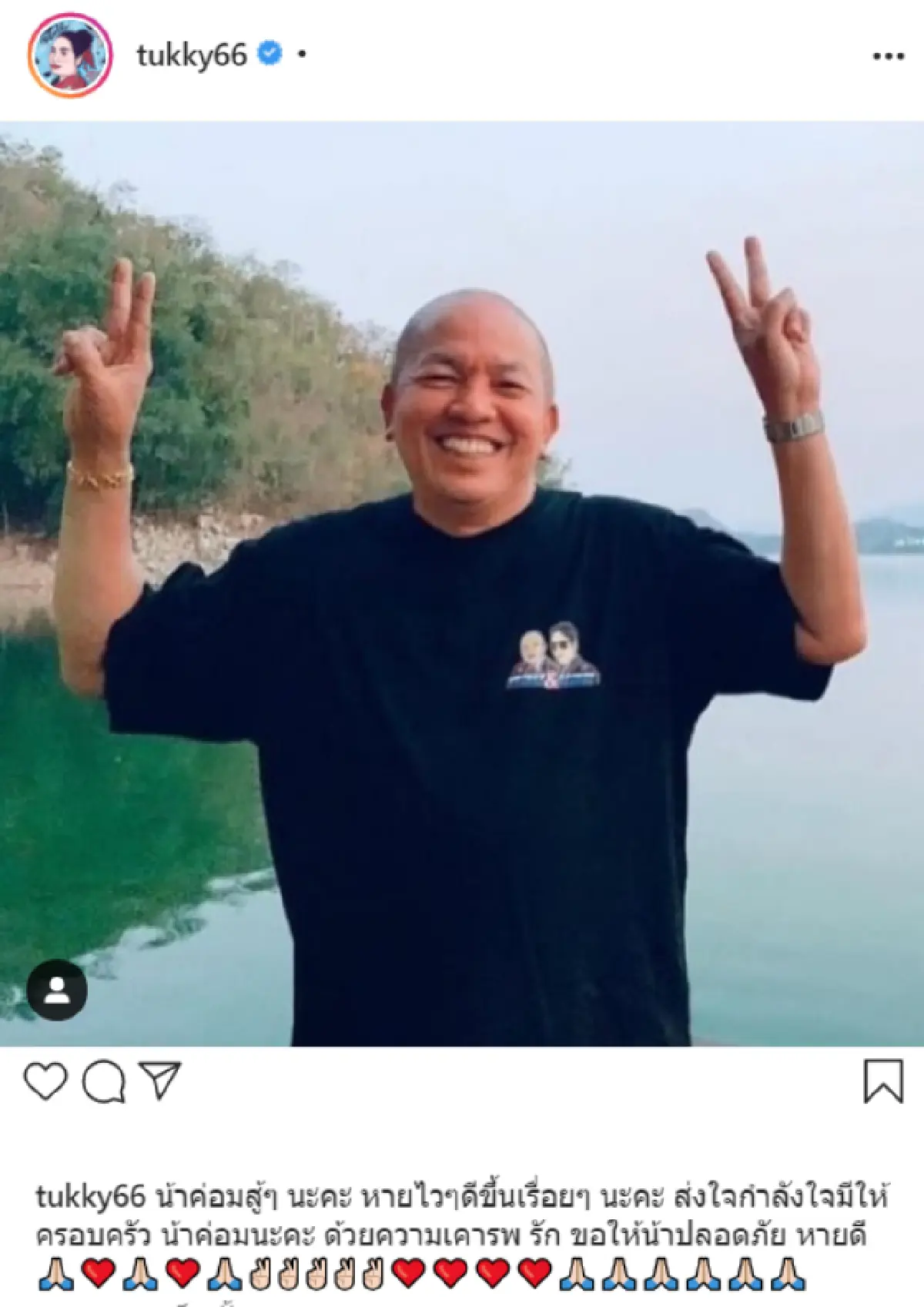 คนบันเทิงแห่ส่งกำลังใจให้ "น้าค่อม ชวนชื่น" หลังอาการทรุด ไตวาย!