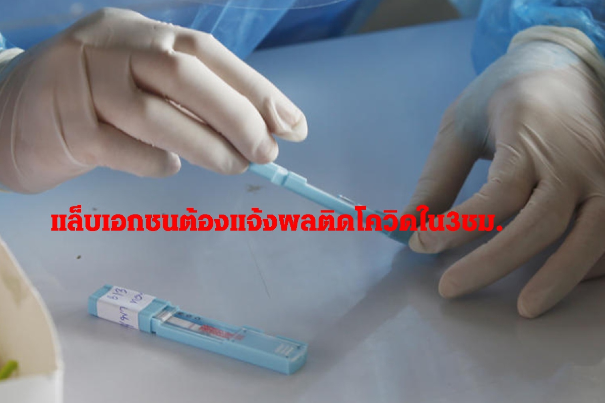 สบส.ย้ำแล็บเอกชนพบเชื้อโควิด-19ต้องผลภายใน 3 ชั่วโมง สบส.ย้ำแล็บเอกชนพบเชื้อโควิด-19ต้องผลภายใน 3 ชั่วโมง