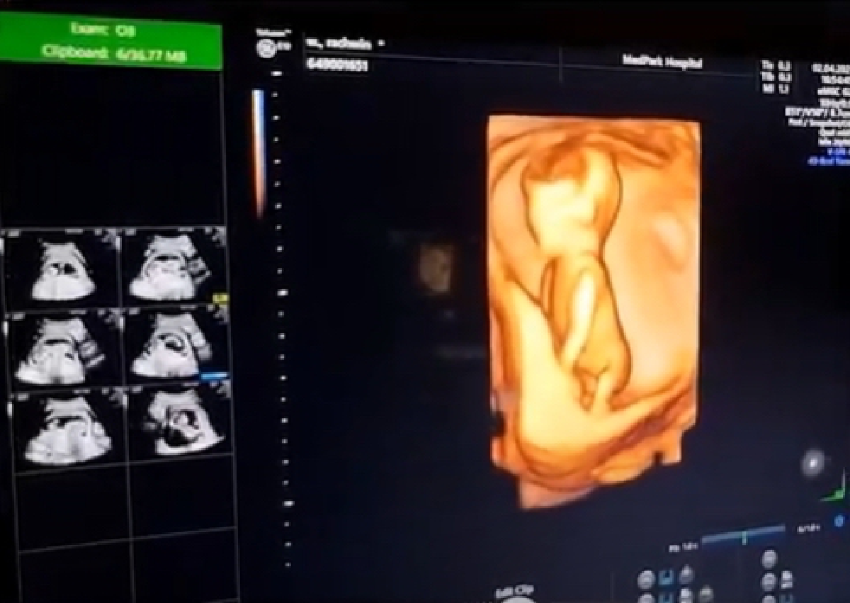 "ก้อย รัชวิน" เผยภาพท้อง 4 เดือนเริ่มชัดมากขึ้น ชาวเน็ตพากันลุ้นจะเป็นชายหรือหญิง