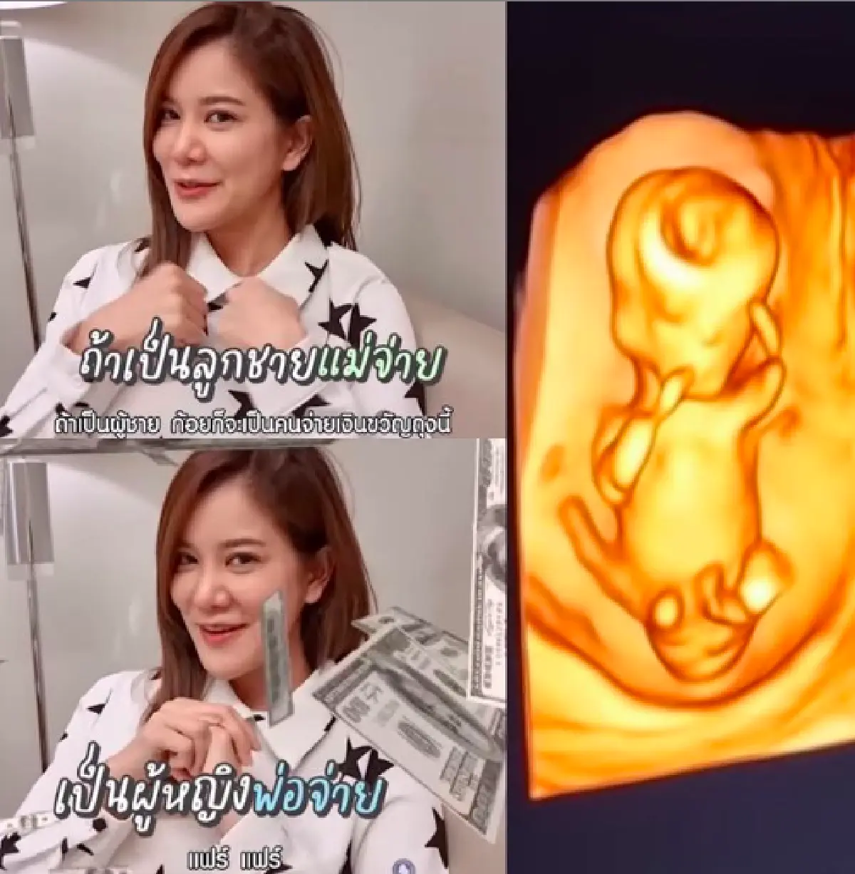 “ก้อย-ตูน” ให้แฟนคลับช่วยกันทายเพศลูก ถ้าเป็นเพศหญิงฝ่ายชายจ่าย 1 ล้านบาท
