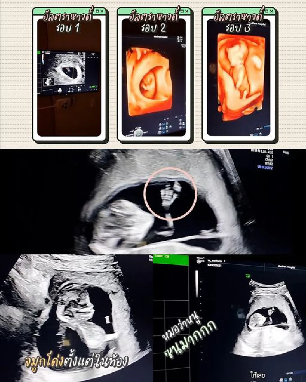 “ก้อย-ตูน” ให้แฟนคลับช่วยกันทายเพศลูก ถ้าเป็นเพศหญิงฝ่ายชายจ่าย 1 ล้านบาท