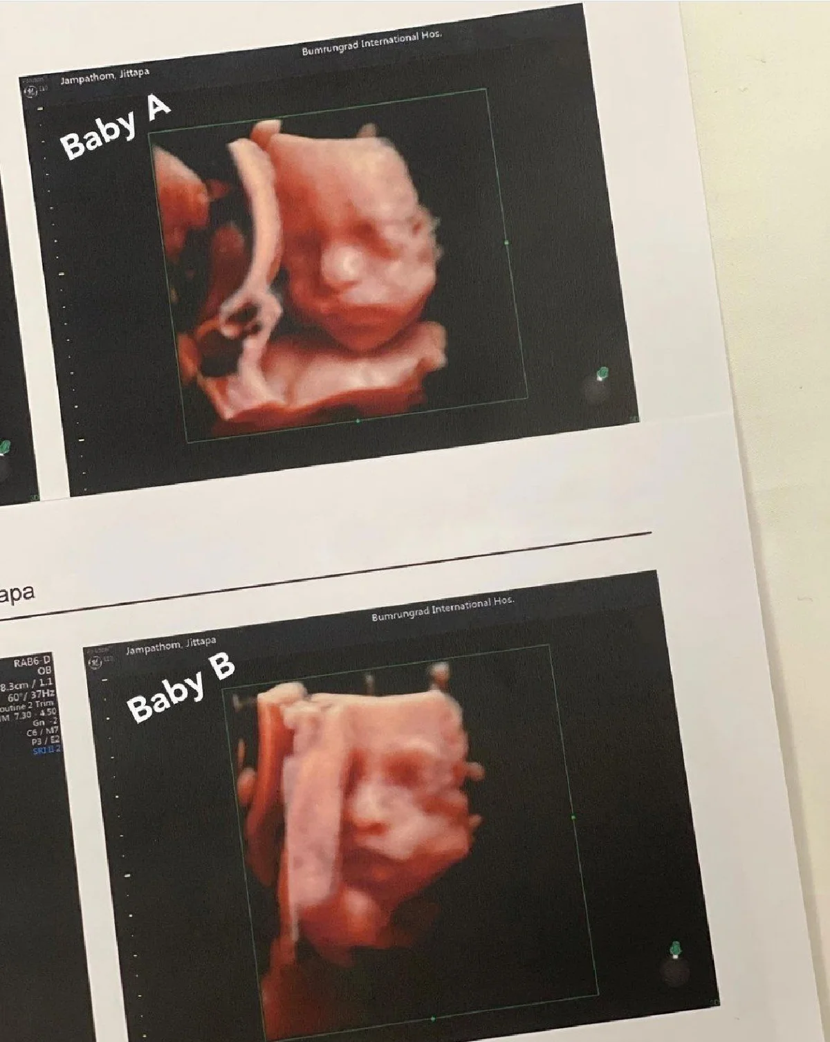 "จ๊ะ จิตตาภา" อุ้มท้องลูกแฝด ควงสามี "เอิน นิธิภัทร์" ถ่ายภาพสุดคูล