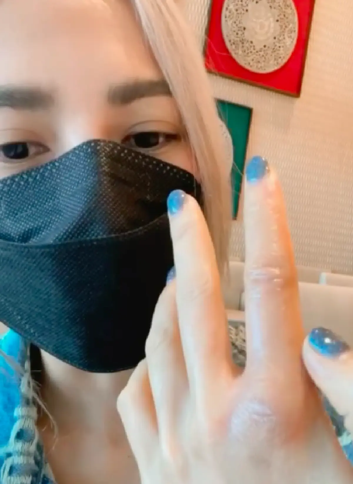  “อุ้ม ลักขณา” ถูกน้ำมันเดือดระเบิดลวกใส่มือ ขณะทอดไก่ให้ “น้องดิสนีย์”