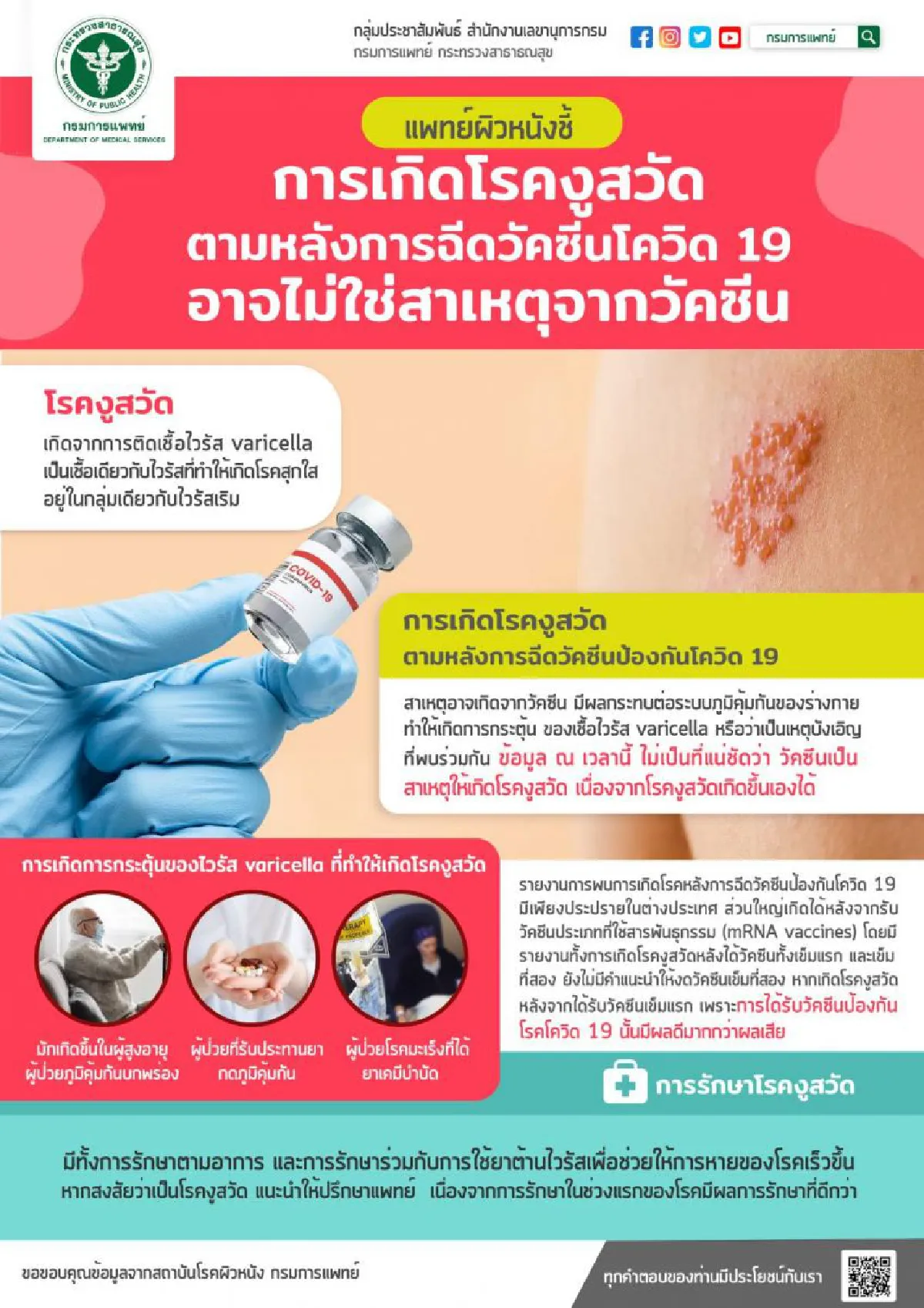 "งูสวัด"หลังฉีดวัคซีน อาจไม่ใช่ผลจากวัคซีน