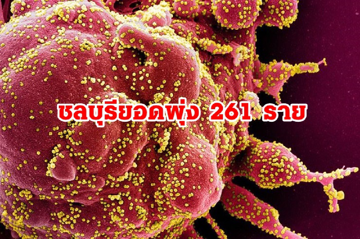 ยอดพุ่ง! "ชลบุรี"ติดโควิด 261 ราย อัพเดตสถานที่เสี่ยงอื้อ ยอดพุ่ง! "ชลบุรี"ติดโควิด 261 ราย อัพเดตสถานที่เสี่ยงอื้อ