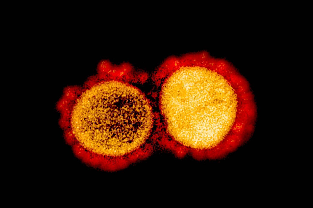 พบ Covid-19 สายพันธุ์ต้านวัคซีน mRNA ในแคลิฟอร์เนีย พบ Covid-19 สายพันธุ์ต้านวัคซีน mRNA ในแคลิฟอร์เนีย