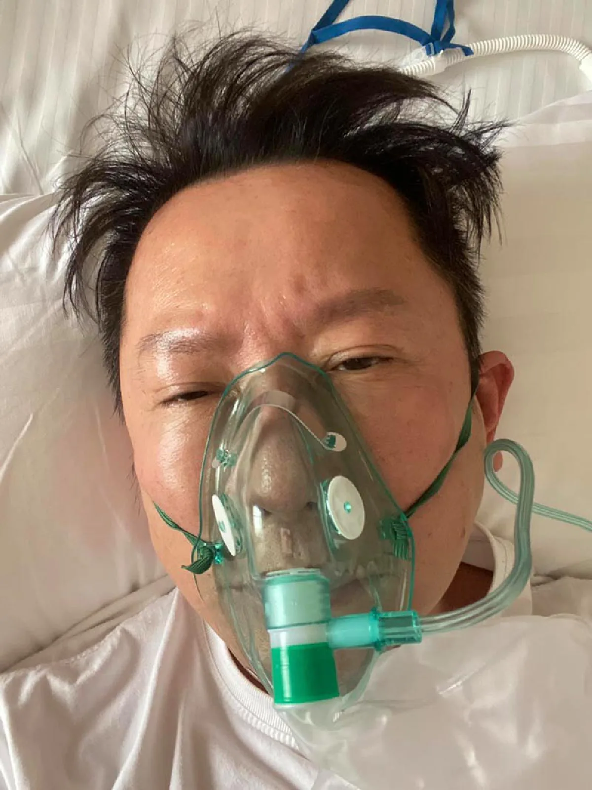 “ณวัฒน์” พบเชื้อเดลตาตัวแรง ต้องฉีดยาต้านทุก 2 ชม. หมอสั่งห้ามขยับตัว!