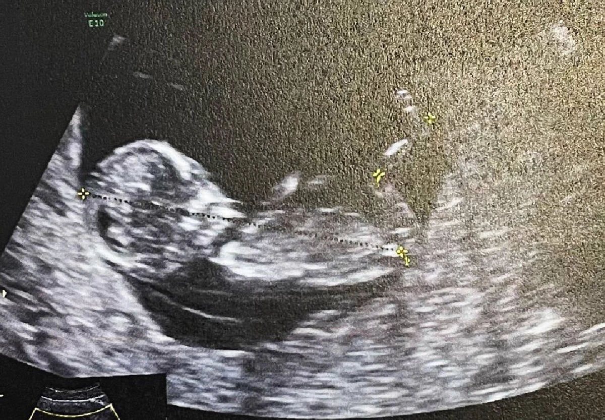 “น้ำชา ชีรณัฐ” ประกาศข่าวดีตั้งท้องแล้ว! เตรียมเป็นคุณแม่ป้ายแดง