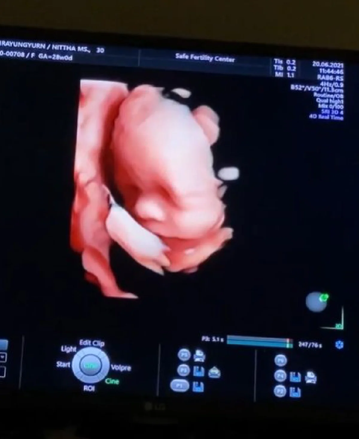 “มิว นิษฐา” สวยเป๊ะมากๆ พร้อมเผยภาพอัลตร้าซาวด์โฉมหน้าลูกสาวแบบชัดๆ 