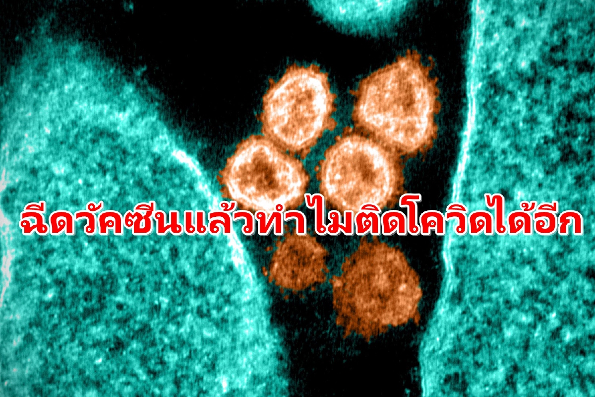 ต้องอยู่กับโรคให้ได้! "นพ.ยง"ชี้เหตุทำไมฉีดวัคซีนแล้วถึงติดโควิดได้ ต้องอยู่กับโรคให้ได้! "นพ.ยง"ชี้เหตุทำไมฉีดวัคซีนแล้วถึงติดโควิดได้