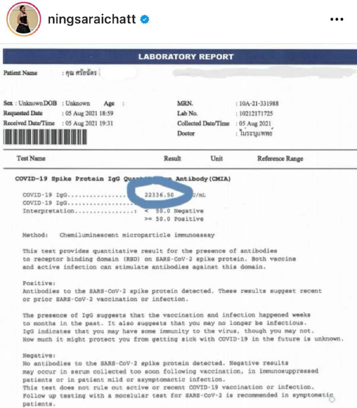  "หนิง ศรัยฉัตร" โชว์ภูมิให้เห็นชัดๆ หลังบูสเข็ม 3 ด้วย mRNA พุ่งกระฉูดมาก