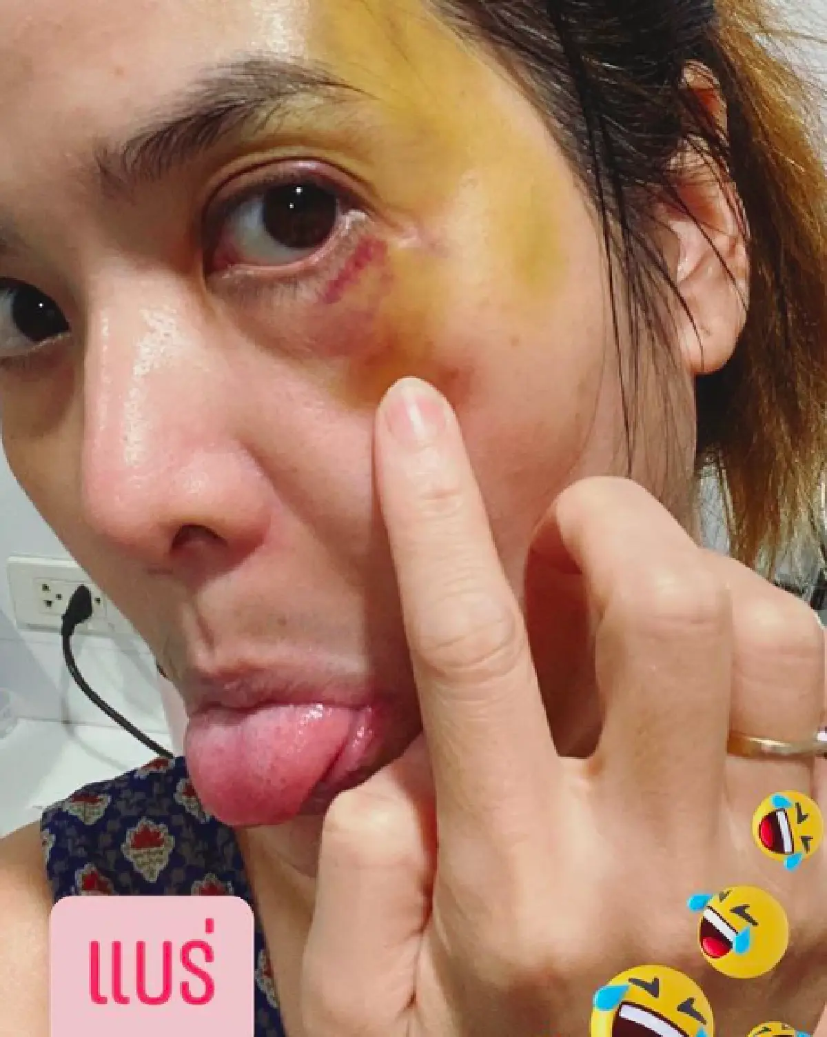 “ปอย ปวีณา” เล่นสเกตบอร์ดแบบไม่มีอุปกรณ์ป้องกัน ล้มหน้าฟาดพื้นหวิดเสียโฉม