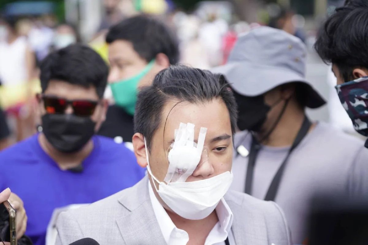 ไฮโซลูกนัทเปิดใจหลังตาบอด "ผมยังเคลื่อนไหวการเมืองเต็มร้อย"