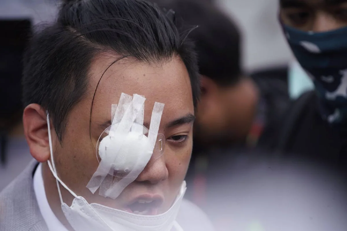 ไฮโซลูกนัทเปิดใจหลังตาบอด "ผมยังเคลื่อนไหวการเมืองเต็มร้อย"