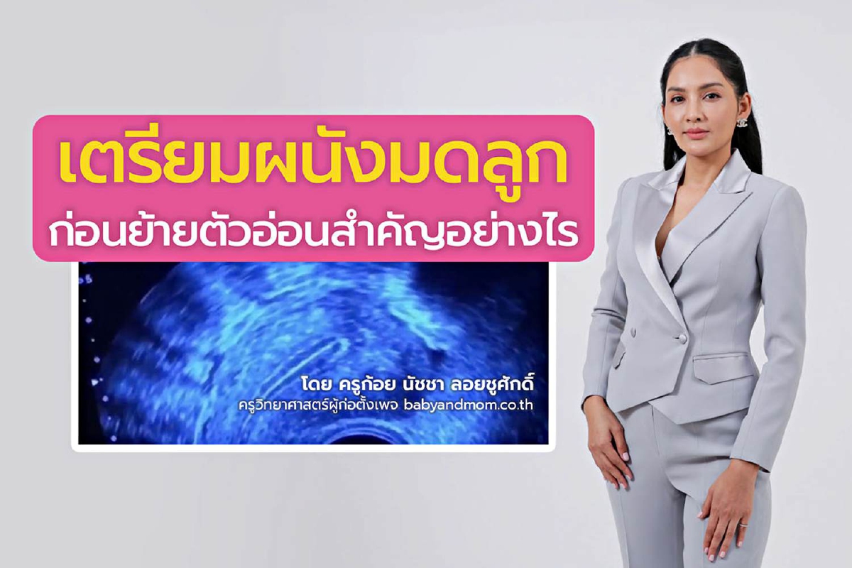 How to เตรียมผนังมดลูกก่อนย้ายตัวอ่อน ขั้นตอนสำคัญของคนมีบุตรยาก How to เตรียมผนังมดลูกก่อนย้ายตัวอ่อน ขั้นตอนสำคัญของคนมีบุตรยาก