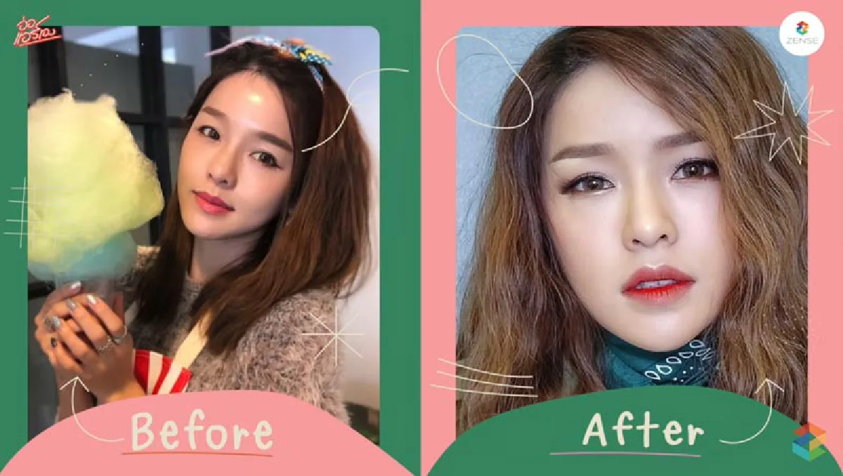 มาไกลแทบจำไม่ได้! “แอร์ ภัณฑิลา” เปิดหมดเปลือกทำหน้าตรงไหนมาบ้าง