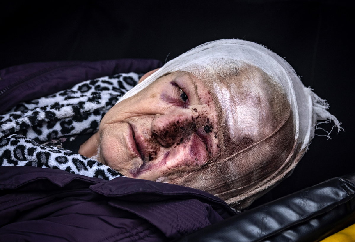 คนรับกรรมคือประชาชนตาดำๆ บันทึกภาพเหยื่อสงครามยูเครน