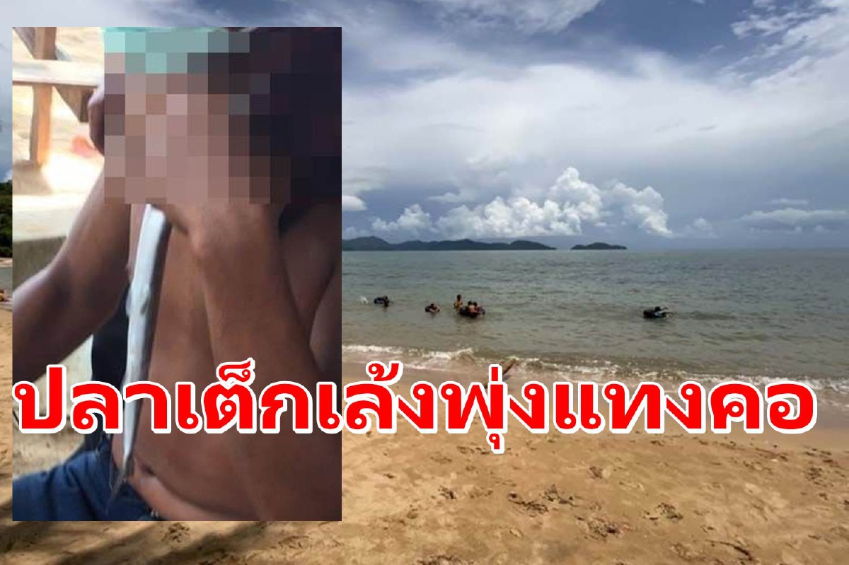 หนุ่มเจอปลาเต็กเล้งพุ่งแทงคอเจ็บขณะเล่นน้ำอ่าวตาลคู่ หนุ่มเจอปลาเต็กเล้งพุ่งแทงคอเจ็บขณะเล่นน้ำอ่าวตาลคู่