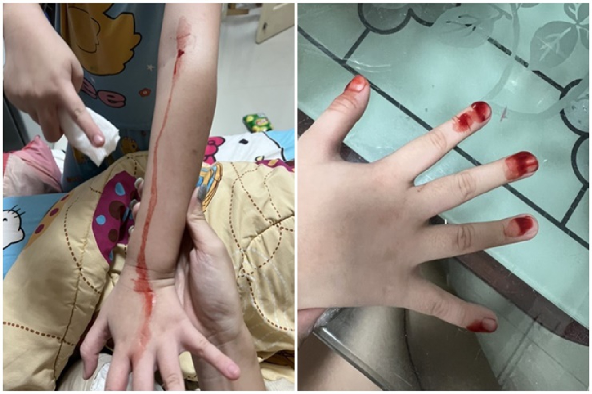 แม่วอนช่วยลูก 7 ขวบ เลือดปริศนาไหลออกตามตัว แม่วอนช่วยลูก 7 ขวบ เลือดปริศนาไหลออกตามตัว