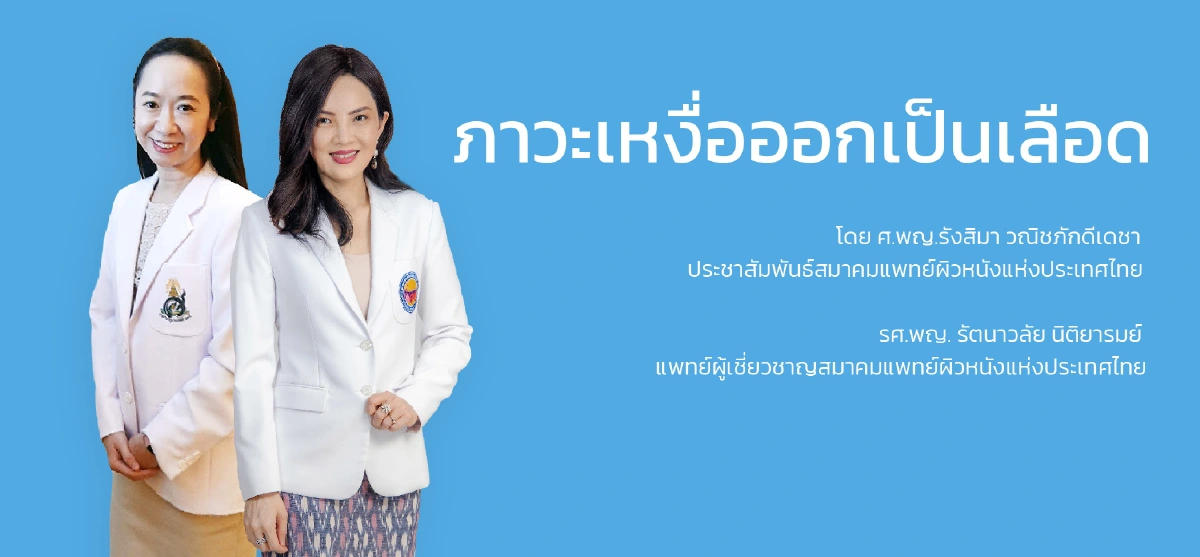 เหงื่อออกเป็นเลือด โรคที่พบน้อย รักษาให้หายขาดได้ 