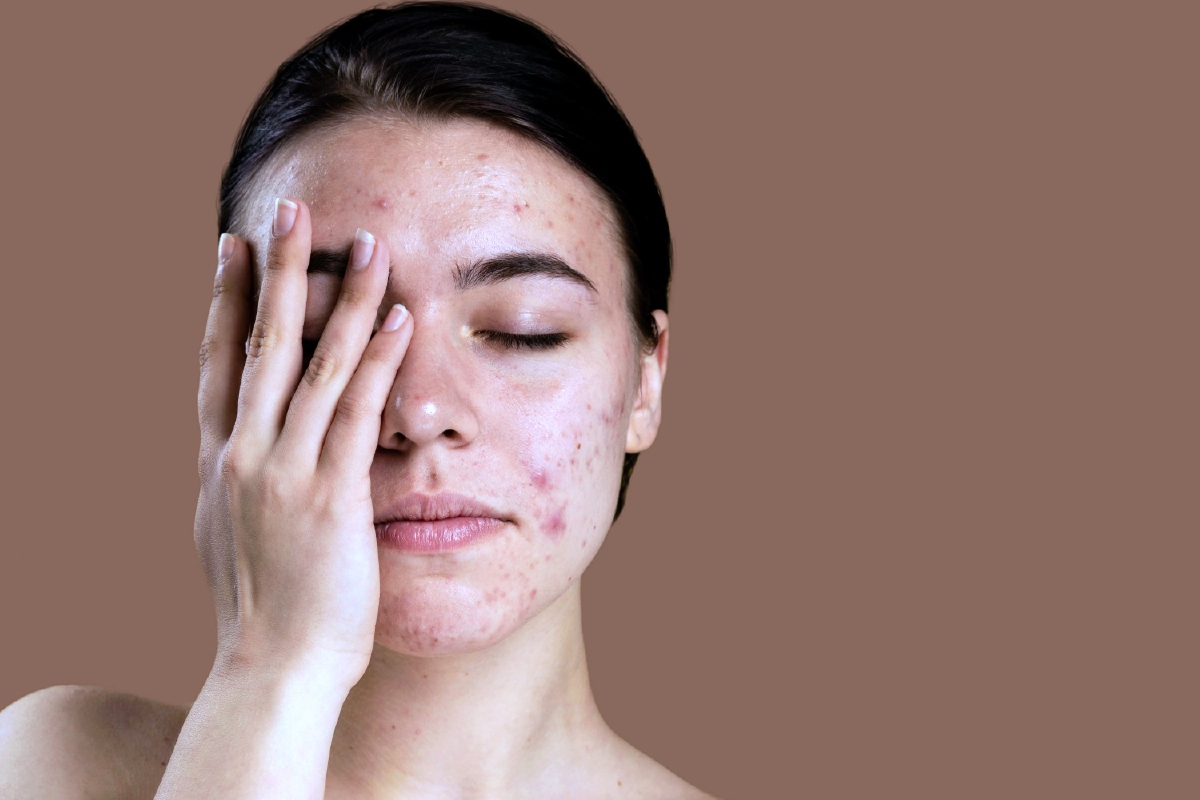Sensitive Skin Awareness Month เดือนแห่งการบอกลาผิวแพ้ง่ายเพื่อผิวสุขภาพดี Sensitive Skin Awareness Month เดือนแห่งการบอกลาผิวแพ้ง่ายเพื่อผิวสุขภาพดี