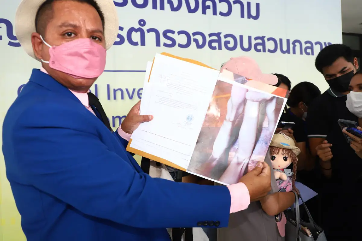 แม่ร้องลูกสาวออทิสติกถูกศูนย์รับเลี้ยงเด็กทำทารุณจนเป็นแผลเต็มตัว
