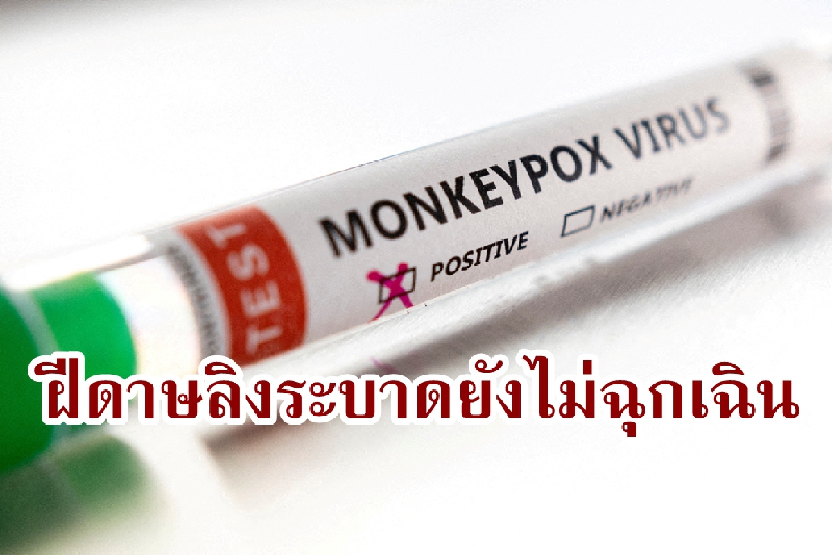 WHO ยันโรคฝีดาษลิงยังไม่เป็นภาวะฉุกเฉินด้านสุขภาพ