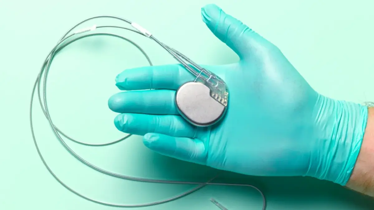 แนวคิดเครื่องกระตุ้นหัวใจรุ่นใหม่ไม่ต้องใช้ไฟฟ้า