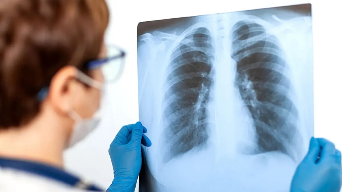 การแพทย์อัจฉริยะ การใช้ปัญญาประดิษฐ์วินิจฉัยและรักษาโรค