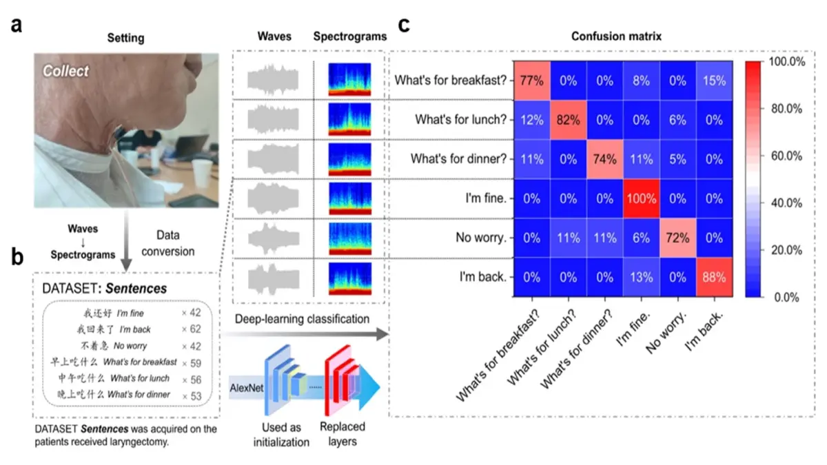 ชิปปัญญาประดิษฐ์ที่ช่วยให้คนเป็นใบ้กลับมาพูดได้