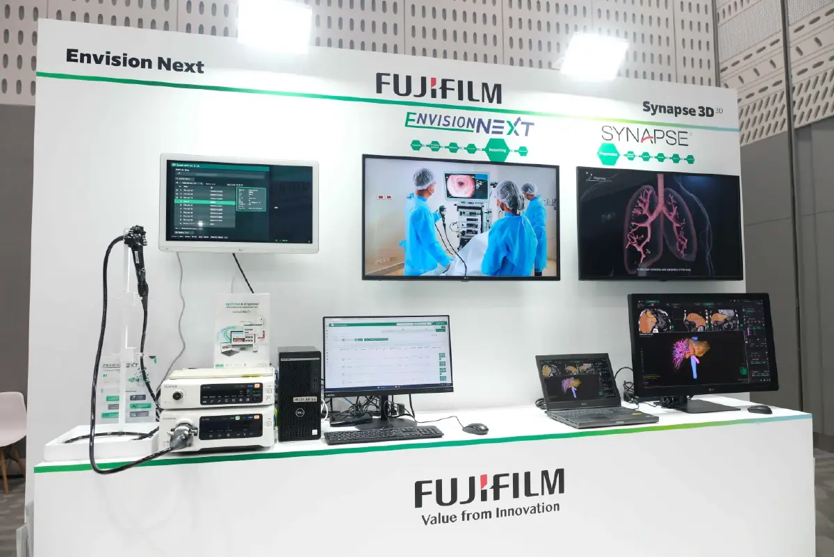 พบกับ CAD EYE นวัตกรรม AI ส่องกล้อง แม่นยำขึ้นตรวจหามะเร็งทางเดินอาหาร