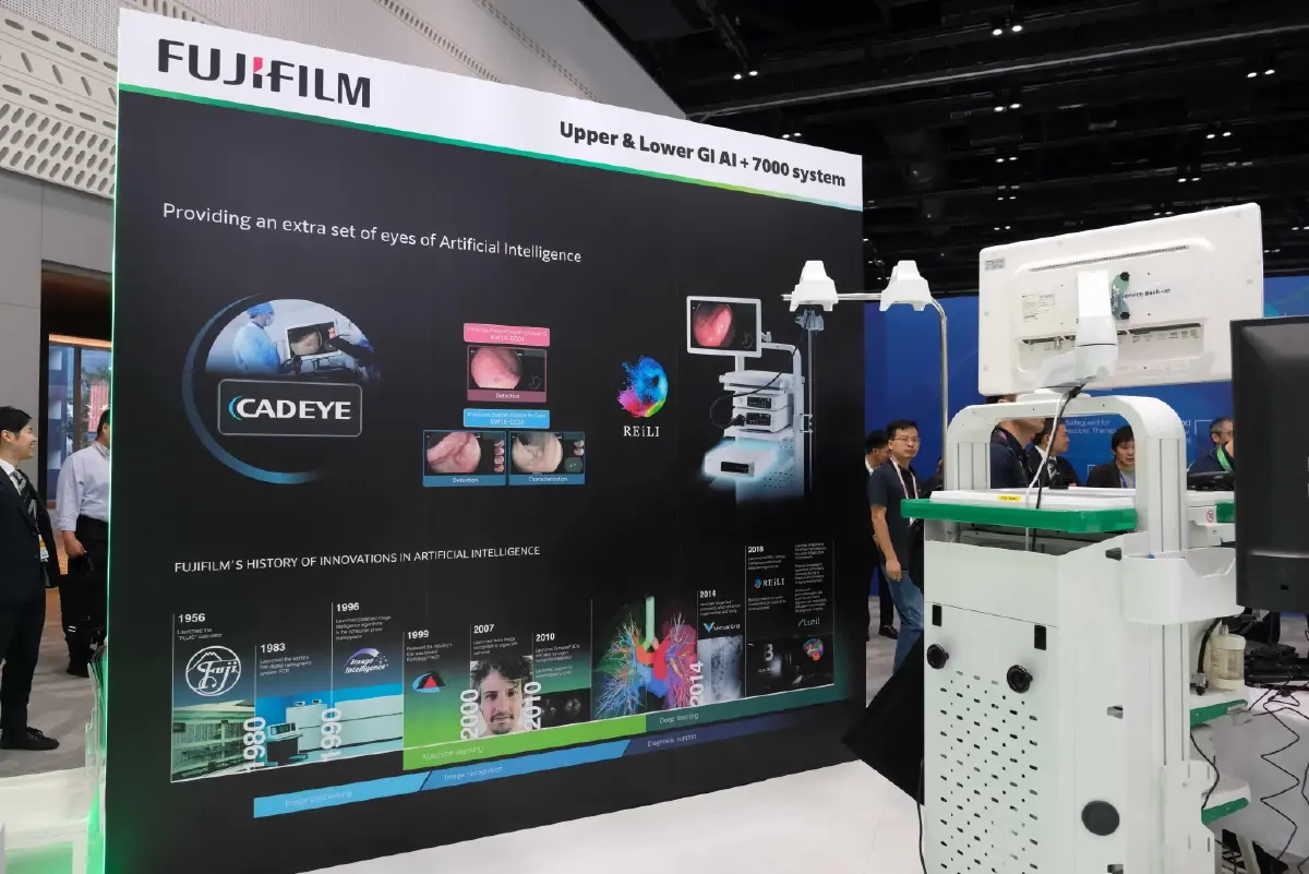 พบกับ CAD EYE นวัตกรรม AI ส่องกล้อง แม่นยำขึ้นตรวจหามะเร็งทางเดินอาหาร