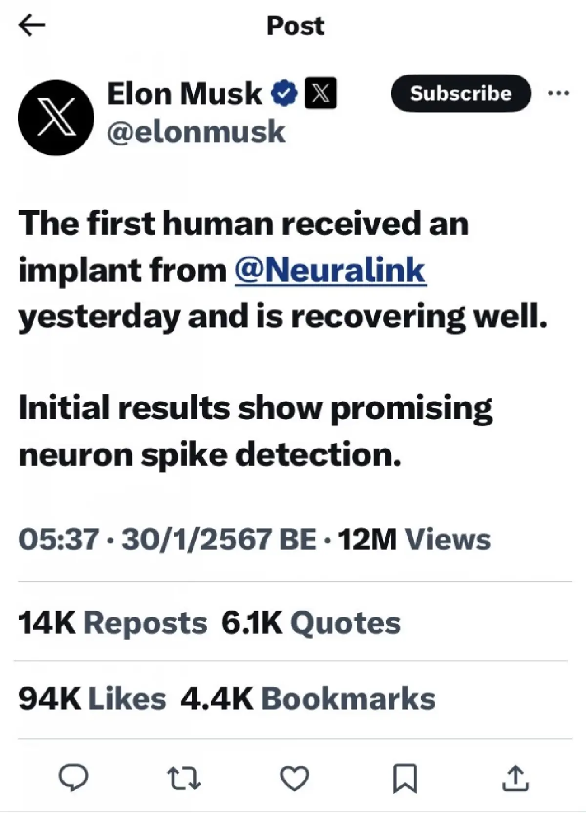 Musk เผย Neuralink ฝังชิปสมองในมนุษย์คนแรกแล้ว
