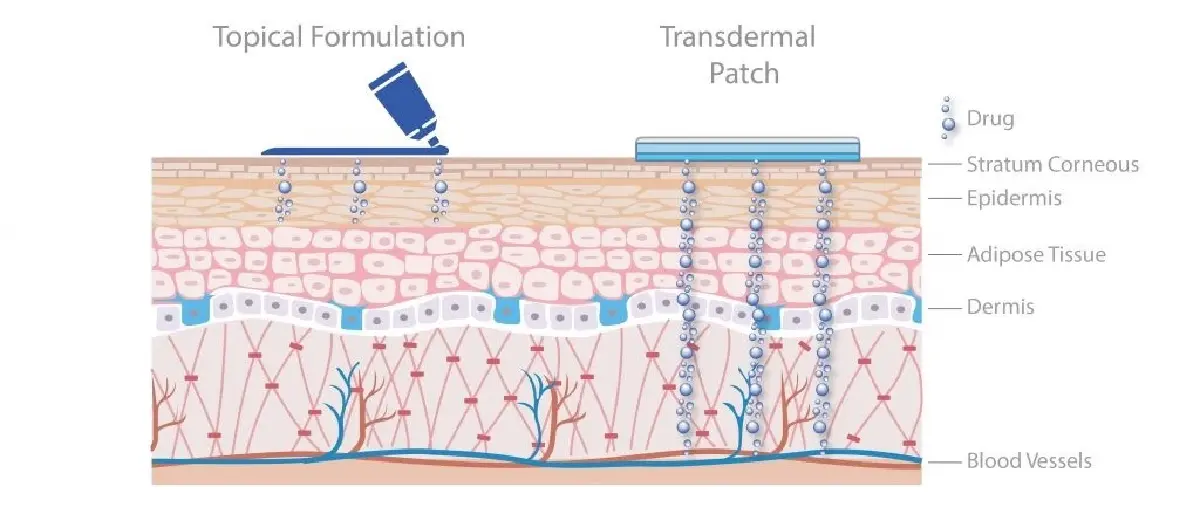 แผ่นแปะอัจฉริยะ รองรับการจ่ายยาอัตโนมัติผ่านสมาร์ทโฟน